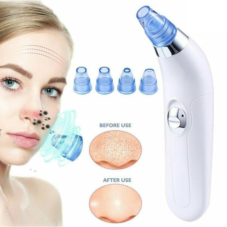 Cell Operated Blackhead Removal Machine...